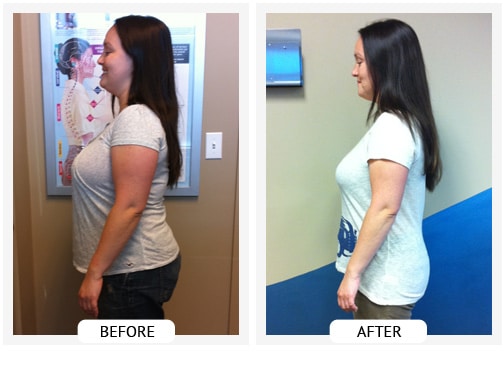 Chiropractic Covington GA Weight Loss Before and After Angelica Chiropractic Covington GA Weight Loss Before and After Angelica