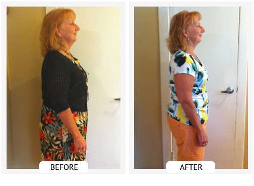 Chiropractic Covington GA Weight Loss Before and After Barb Chiropractic Covington GA Weight Loss Before and After Barb