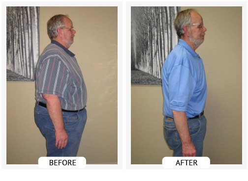 Chiropractic Covington GA Weight Loss Before and After Bill Chiropractic Covington GA Weight Loss Before and After Bill