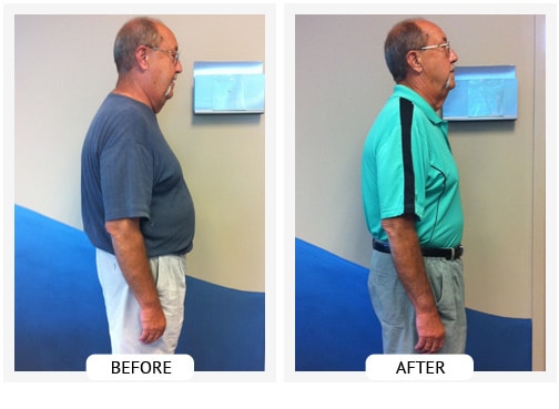 Chiropractic Covington GA Weight Loss Before and After Dan Chiropractic Covington GA Weight Loss Before and After Dan