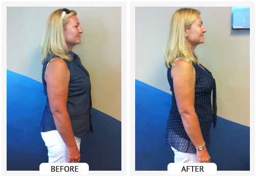 Chiropractic Covington GA Weight Loss Before and After Jeanie Chiropractic Covington GA Weight Loss Before and After Jeanie