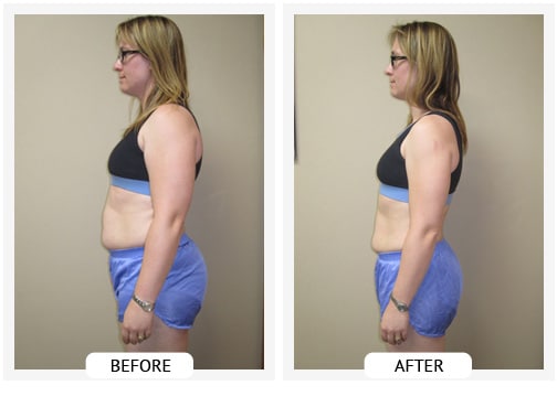 Chiropractic Covington GA Weight Loss Before and After Kristen Chiropractic Covington GA Weight Loss Before and After Kristen