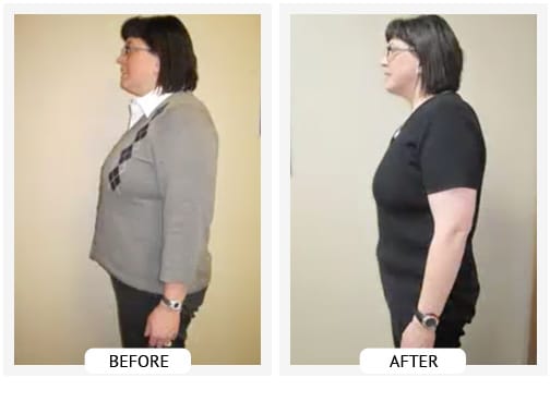 Chiropractic Covington GA Weight Loss Before and After Lisa Chiropractic Covington GA Weight Loss Before and After Lisa