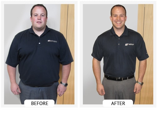 Chiropractic Covington GA Weight Loss Before and After Sheldon Chiropractic Covington GA Weight Loss Before and After Sheldon