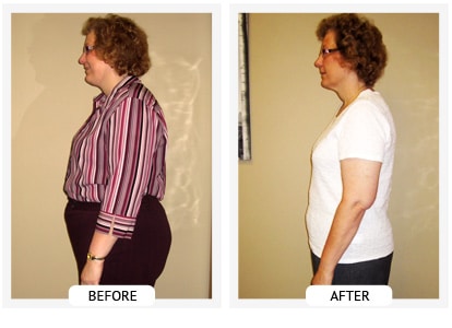 Chiropractic Covington GA Weight Loss Before and After Sherry Chiropractic Covington GA Weight Loss Before and After Sherry